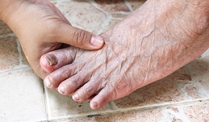 Symptoms and Risks of Toenail Fungus